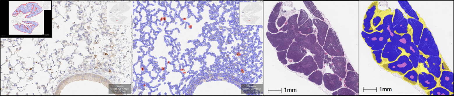 Examples of quantitative image analysis performed by the core on digitized whole glass slides, including quantitation of immunolabelled cells (panels A and B) and training of a machine learning-based classifier to separate tissue regions (panels C and D)