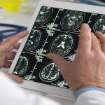 Researcher looks at brain scans on a handheld tablet