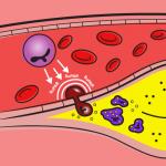 suPAR cells blood vessels plaque