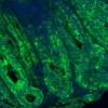 Green staining shows mTORC1 is significantly increased due to disruption in GATOR1 in a mouse model of colon cancer. Credit: Sumeet Solanki, Ph.D.