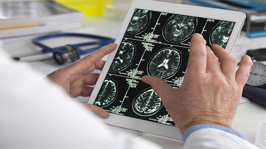 Researcher looks at brain scans on a handheld tablet