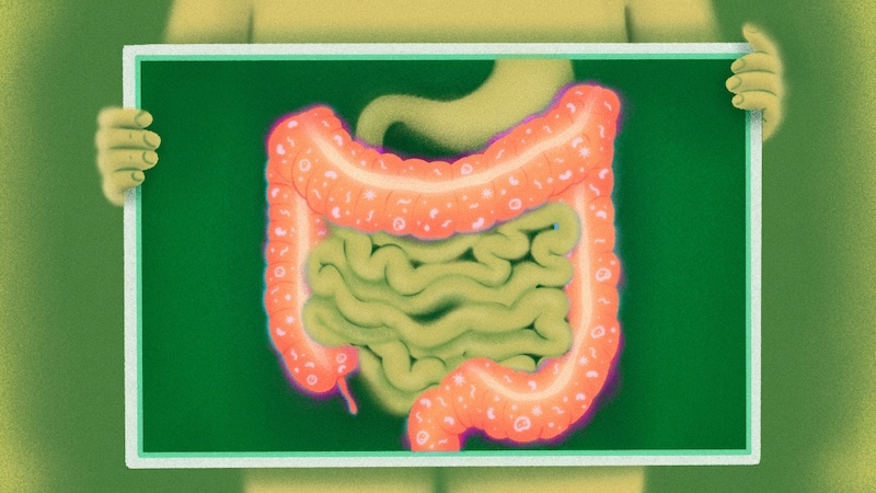Illustration of green background with intestines in pink