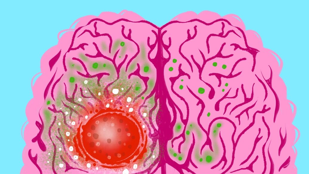 Illustration on light blue background with pink brain with red circle area growing