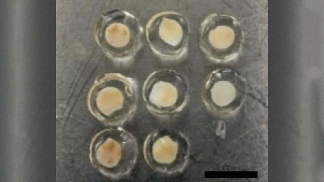 Human ovarian tissue samples encapsulated in immune-isolating hydrogels, just before implantation for testing. The new study in mice shows that encapsulated donor ovarian tissue releases hormones that integrate with the host endocrine system. Credit: Shikanov Lab, University of Michigan