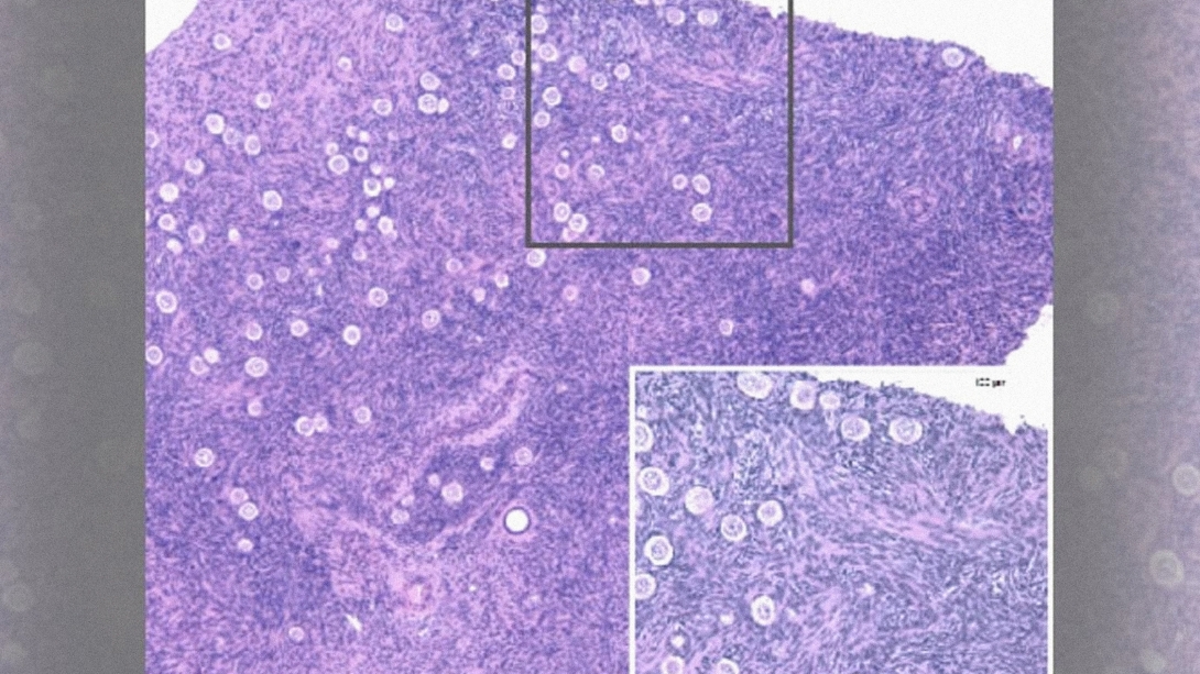 A histological section of human ovarian tissue shows hundreds of ovarian follicles—the functional units of the ovary capable of growing and secreting hormones.