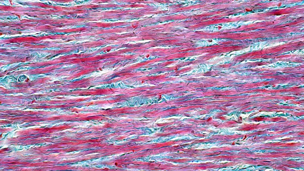 pink and blue mixed in close up microscopic view of tendon cells